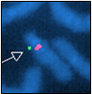 Imprinting centre and SNRPN probes from 15q11.2